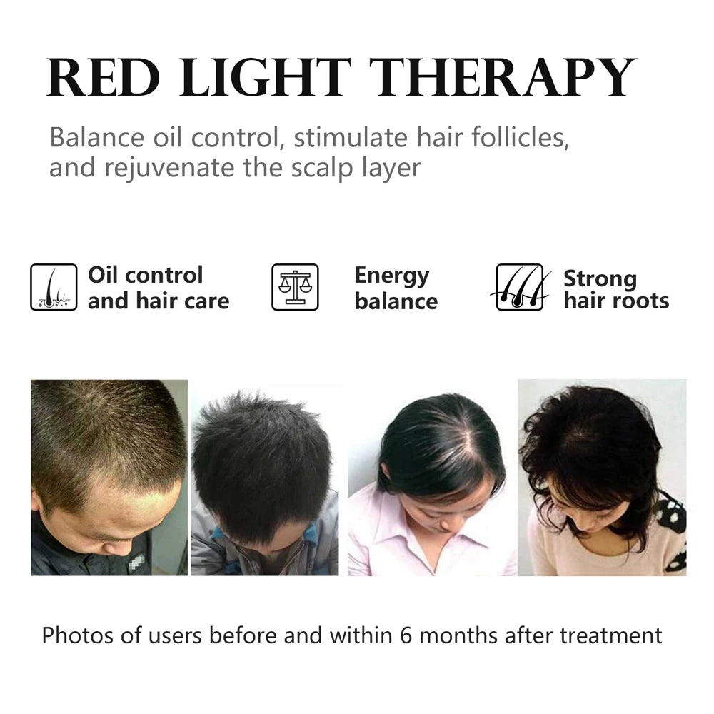 Hair Growth Device LED Face Mask LLLT 4 Colors 660nm 850nm Skin Rejuvenation&Whiten Anti Aging Prevent Hair Loss& Nourish Hair