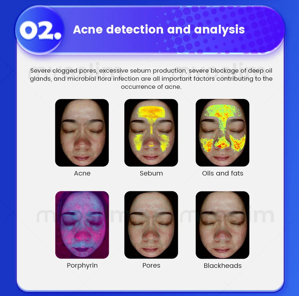 Professional 3D Facial Skin Analyzer Scanner with Dermatoscope and Face Mirror for Skin Face Diagnostics Analysis Machine.
